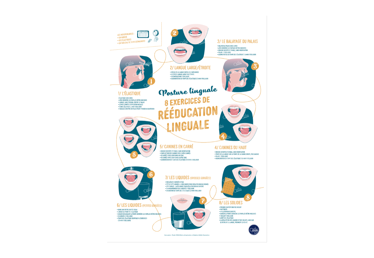 Image sur le produit Affiche A2 - Posture linguale