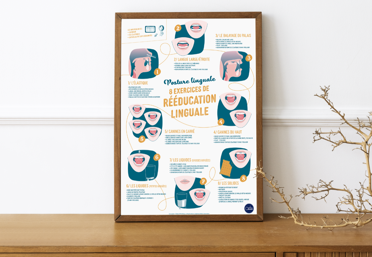 Image principale de Affiche A2 - Posture linguale