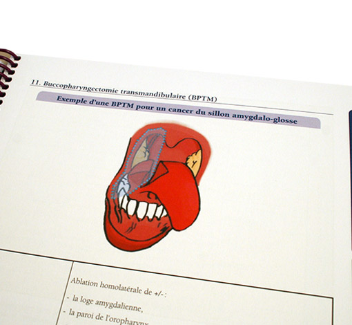 Image de Prise en soin orthophonique du patient dysphagique suite à un cancer bucco-pharyngo-laryngé, produit d'Ortho Édition