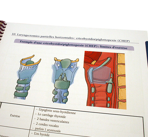 Image de Prise en soin orthophonique du patient dysphagique suite à un cancer bucco-pharyngo-laryngé, produit d'Ortho Édition