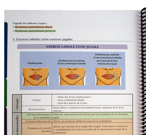 Image de Prise en soin orthophonique du patient dysphagique suite à un cancer bucco-pharyngo-laryngé, produit d'Ortho Édition